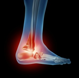 ankle-pain-ca