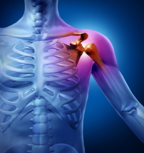 arthritis-pain-shoulder-ca